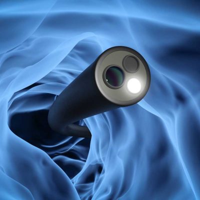 Ewgeni_rosengruen_endoskopie_288112527